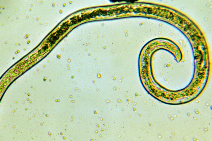 parasitic worms in humans